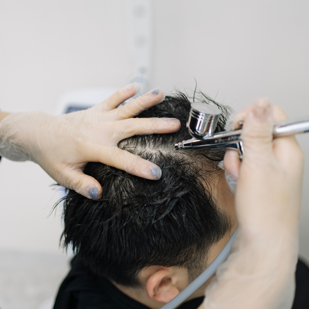 Hair Mesotherapy Process